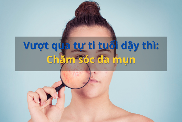 Vượt qua tự ti tuổi dậy thì: Chăm sóc da mụn